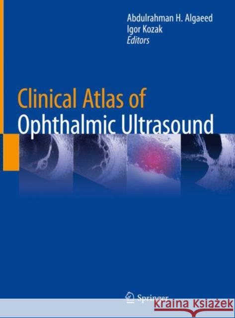 Clinical Atlas of Ophthalmic Ultrasound Abdulrahman H. Algaeed Igor Kozak 9783319998695 Springer