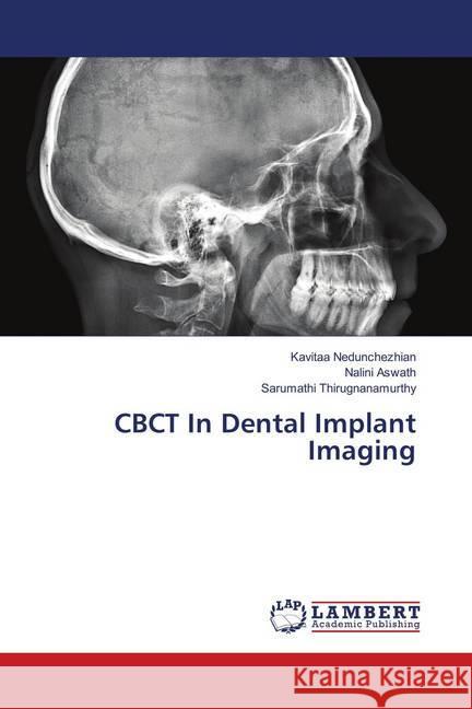 CBCT In Dental Implant Imaging Nedunchezhian, Kavitaa; Aswath, Nalini; Thirugnanamurthy, Sarumathi 9783330002173