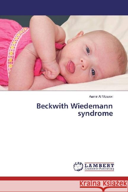 Beckwith Wiedemann syndrome Al Mosawi, Aamir 9783330007598 LAP Lambert Academic Publishing