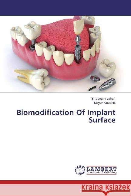 Biomodification Of Implant Surface Jahan, Shabnam; Kaushik, Mayur 9783330014930 LAP Lambert Academic Publishing