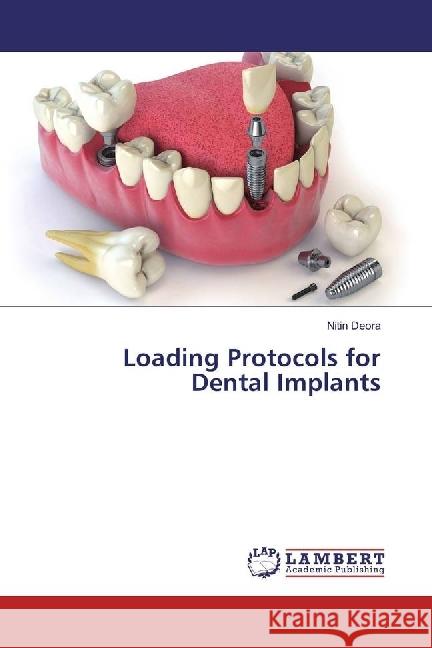 Loading Protocols for Dental Implants Deora, Nitin 9783330017450