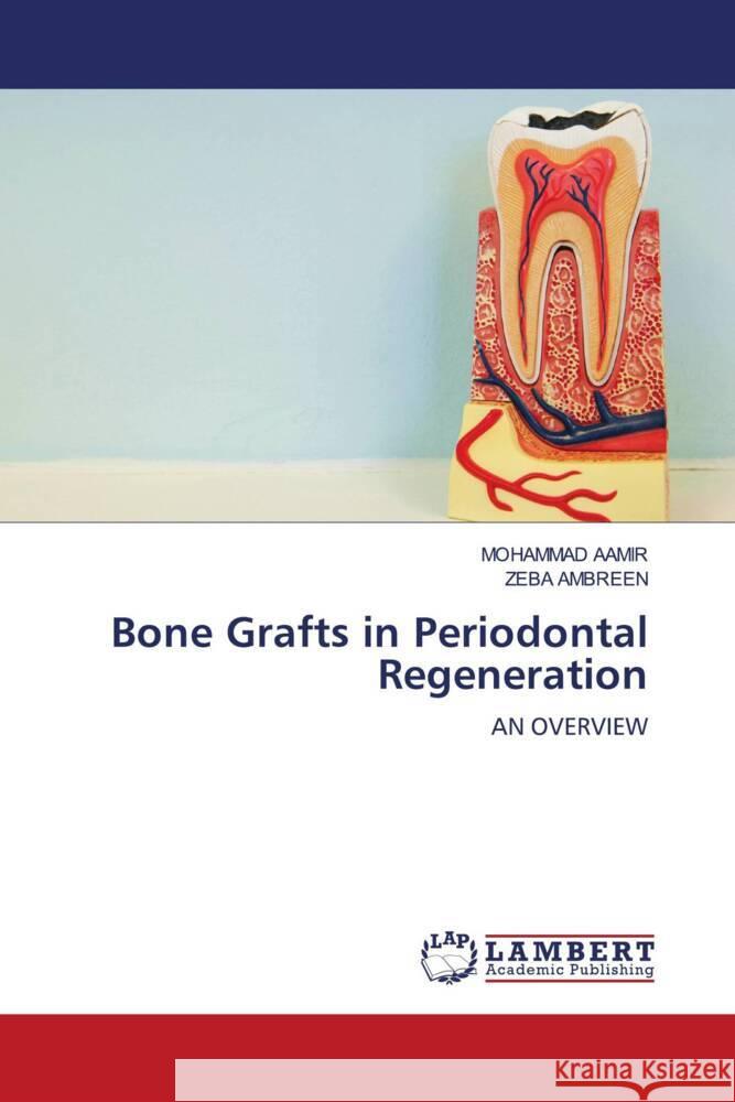 Bone Grafts in Periodontal Regeneration AAMIR, MOHAMMAD, Ambreen, Zeba 9783330033375 LAP Lambert Academic Publishing