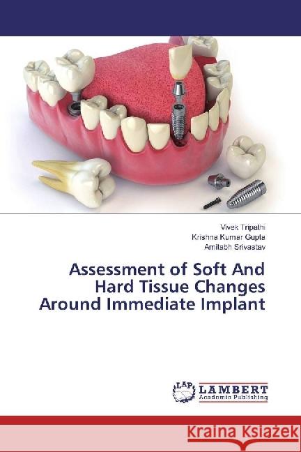 Assessment of Soft And Hard Tissue Changes Around Immediate Implant Tripathi, Vivek; Gupta, Krishna Kumar; Srivastav, Amitabh 9783330042490 LAP Lambert Academic Publishing