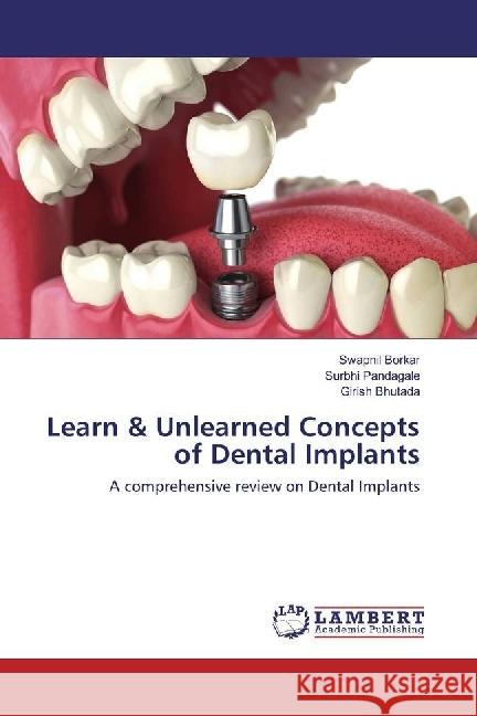 Learn & Unlearned Concepts of Dental Implants : A comprehensive review on Dental Implants Borkar, Swapnil; Pandagale, Surbhi; Bhutada, Girish 9783330051393