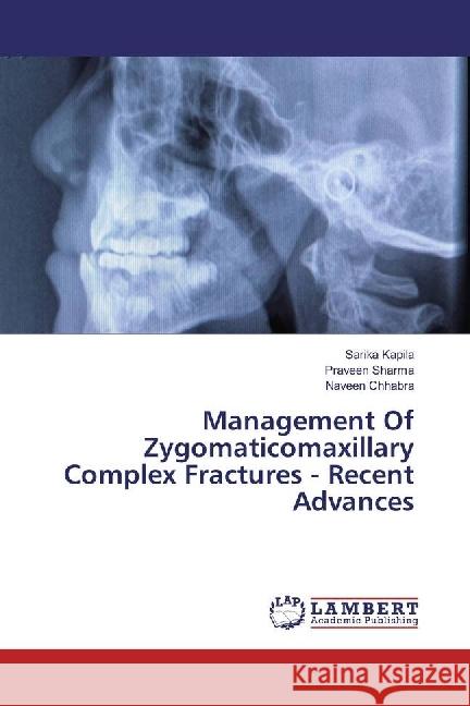 Management Of Zygomaticomaxillary Complex Fractures - Recent Advances Kapila, Sarika; Sharma, Praveen; Chhabra, Naveen 9783330074439