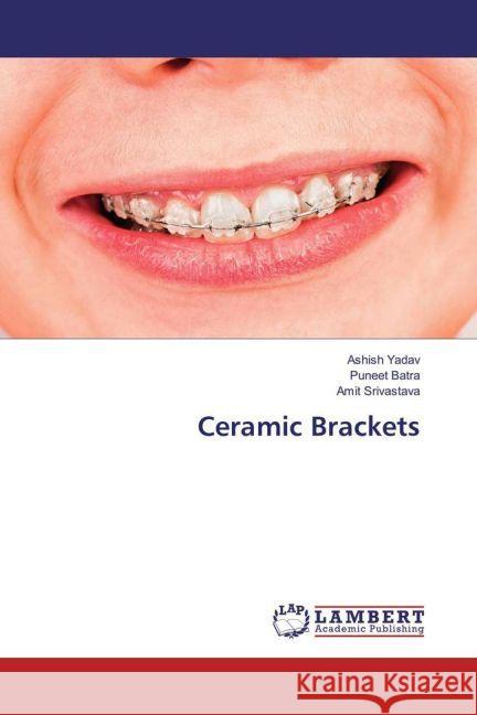 Ceramic Brackets Yadav, Ashish; Batra, Puneet; Srivastava, Amit 9783330081505