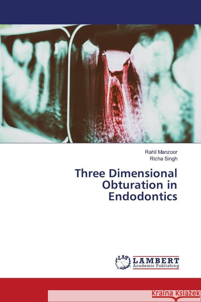 Three Dimensional Obturation in Endodontics Manzoor, Rahil, Singh, Richa 9783330082861 LAP Lambert Academic Publishing