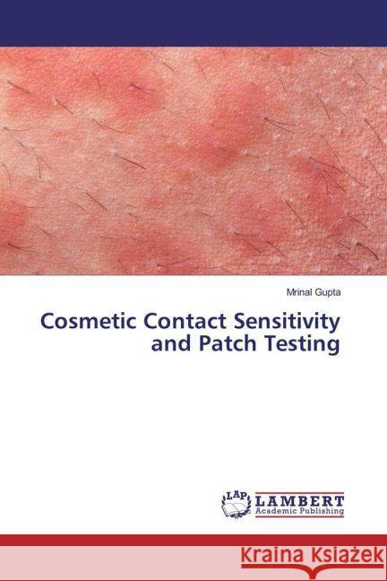 Cosmetic Contact Sensitivity and Patch Testing Gupta, Mrinal 9783330090460