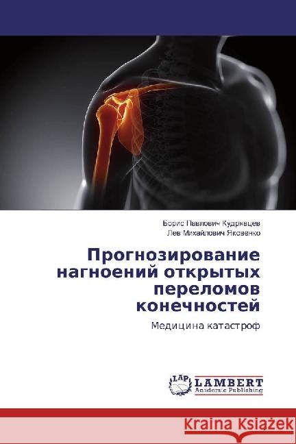 Prognozirovanie nagnoenij otkrytyh perelomov konechnostej : Medicina katastrof Kudryavcev, Boris P.; Yakovenko, Lev M. 9783330090644 LAP Lambert Academic Publishing