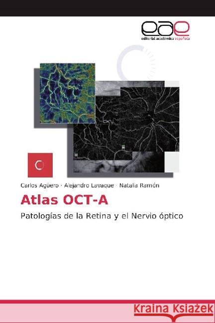 Atlas OCT-A : Patologías de la Retina y el Nervio óptico Agüero, Carlos; Lavaque, Alejandro; Ramón, Natalia 9783330097186