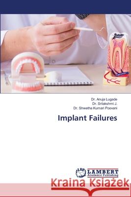 Implant Failures Lugade, Dr. Anuja, J., Dr. Srilakshmi, Poovani, Dr. Shwetha Kumari 9783330320000 LAP Lambert Academic Publishing