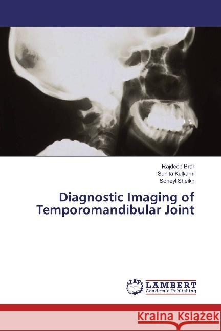 Diagnostic Imaging of Temporomandibular Joint Brar, Rajdeep; Kulkarni, Sunita; Sheikh, Soheyl 9783330329416