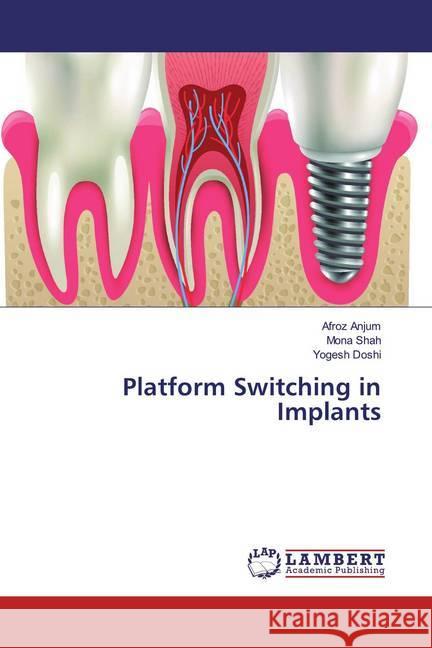 Platform Switching in Implants Anjum, Afroz; Shah, Mona; Doshi, Yogesh 9783330349810 LAP Lambert Academic Publishing