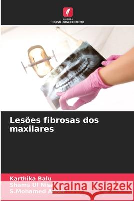 Les?es fibrosas dos maxilares Karthika Balu Shams Ul Nisa S. Mohamed Anser 9783330511644