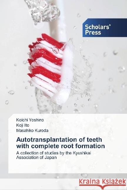 Autotransplantation of teeth with complete root formation : A collection of studies by the Kyushikai Association of Japan Yoshino, Koichi; Ito, Koji; Kuroda, Masahiko 9783330651487 Scholar's Press