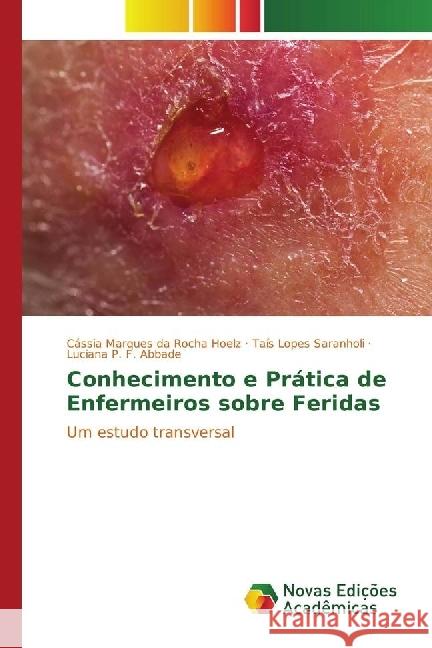 Conhecimento e Prática de Enfermeiros sobre Feridas : Um estudo transversal Hoelz, Cássia Marques da Rocha; Saranholi, Taís Lopes; Abbade, Luciana P. F. 9783330766112 Novas Edicioes Academicas