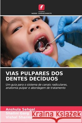 VIAS PULPARES DOS DENTES DECÍDUOS Sehgal, Anshula, Garg, Shalini, Sharma, Vishal 9783330823891 Edições Nosso Conhecimento