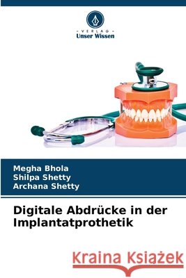 Digitale Abdr?cke in der Implantatprothetik Megha Bhola Shilpa Shetty Archana Shetty 9783330825567
