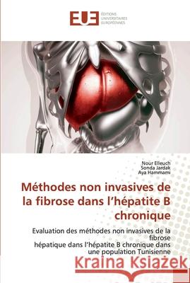 Méthodes non invasives de la fibrose dans l'hépatite B chronique Nour Elleuch, Sonda Jardak, Aya Hammami 9783330869325 Editions Universitaires Europeennes