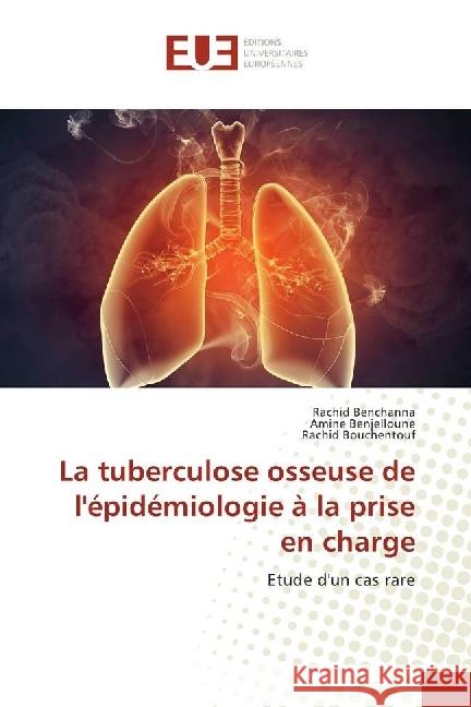 La tuberculose osseuse de l'épidémiologie à la prise en charge : Etude d'un cas rare Benchanna, Rachid; Benjelloune, Amine; Bouchentouf, Rachid 9783330872608 Éditions universitaires européennes