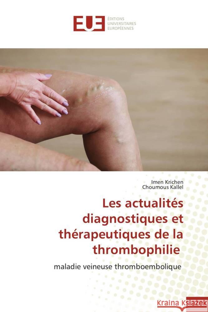 Les actualités diagnostiques et thérapeutiques de la thrombophilie Krichen, Imen, Kallel, Choumous 9783330874176