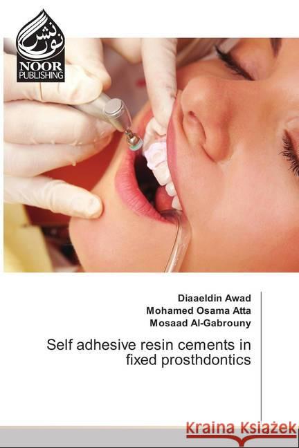 Self adhesive resin cements in fixed prosthdontics Awad, Diaaeldin; Atta, Mohamed Osama; Al-Gabrouny, Mosaad 9783330968288