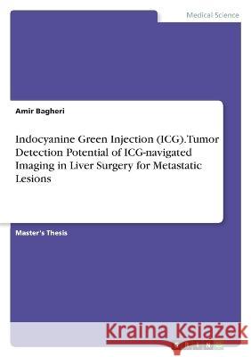 Indocyanine Green Injection (ICG). Tumor Detection Potential of ICG-navigated Imaging in Liver Surgery for Metastatic Lesions Amir Bagheri 9783346768995