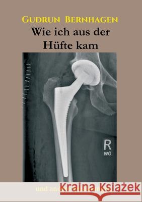 Wie ich aus der Hüfte kam: Und andere Erzählungen Bernhagen, Gudrun 9783347043299