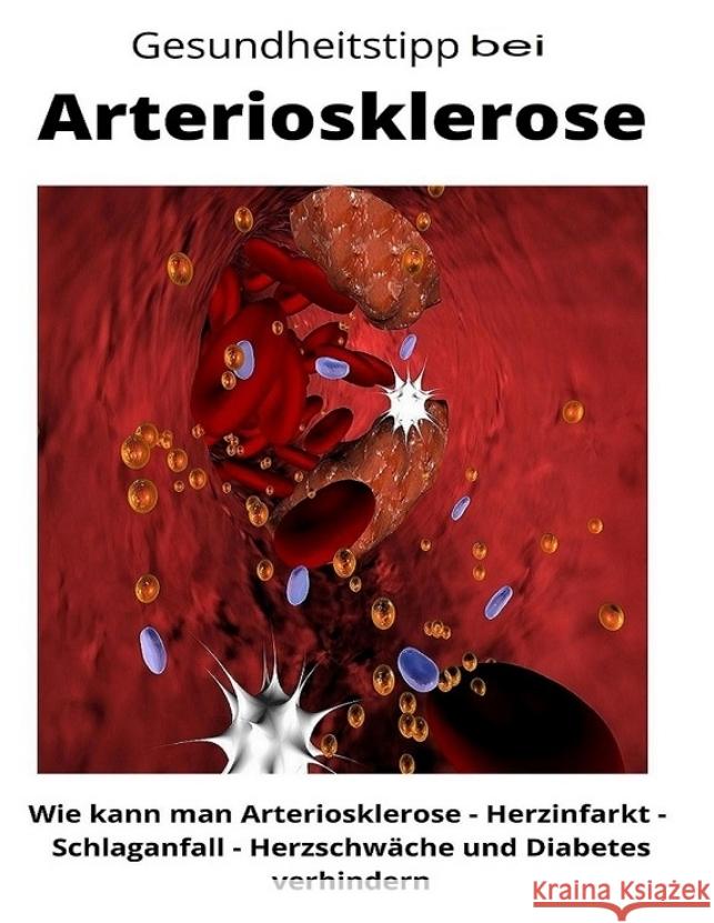 Gesundheitstipp bei Arteriosklerose Loidl, Maximilian 9783347760394