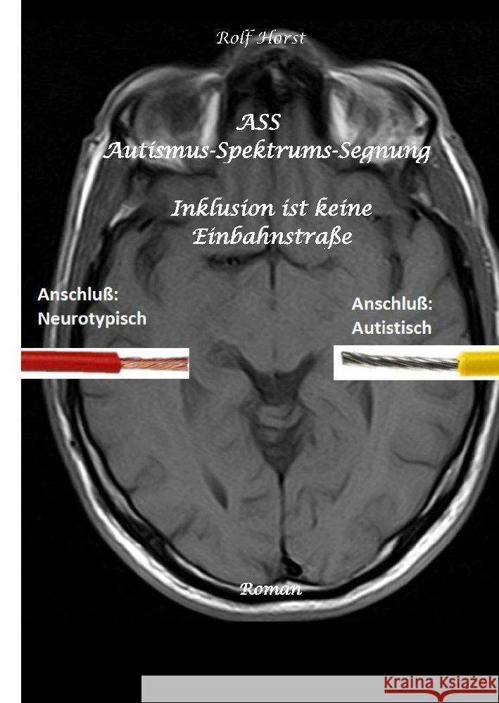 ASS Autismus-Spektrums-Segnung - Asperger-Syndrom, Sucht, Alkoholismus, Spiritualität, Buddhismus, Mobbing, Ausgrenzung, Missbrauch Horst, Rolf 9783347879171