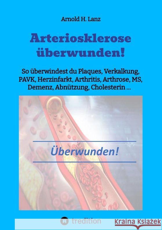 Arteriosklerose überwunden! Lanz, Arnold H. 9783384006479 tredition