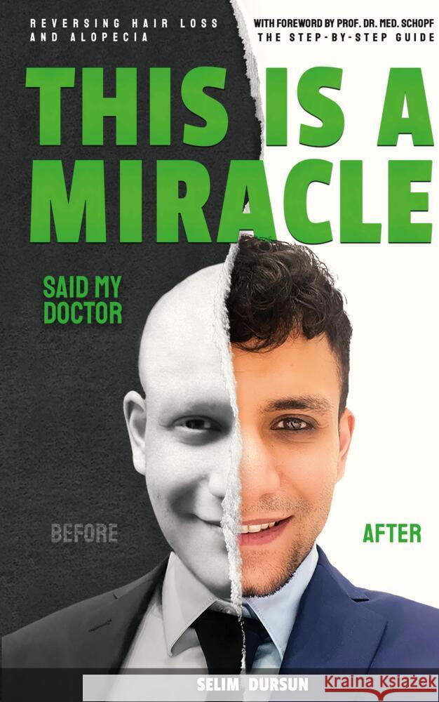 This Is a Miracle Said My Doctor: Reversing Hair Loss and Alopecia Selim Dursun 9783384063441