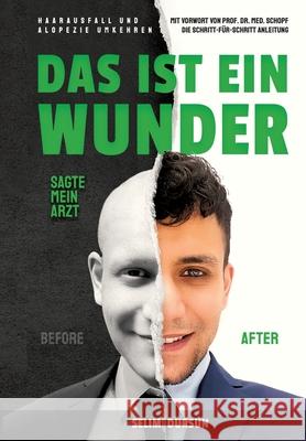 Das Ist Ein Wunder Sagte Mein Arzt: Haarverlust Und Alopezie Umkehren Selim Dursun 9783384300515