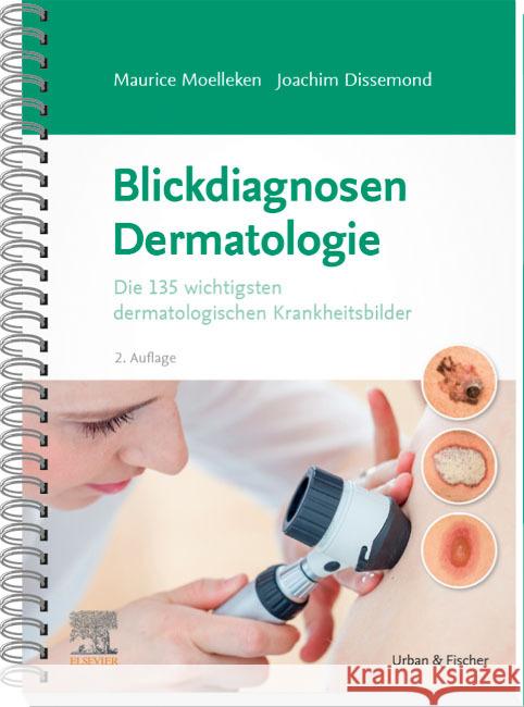 Blickdiagnosen Dermatologie Moelleken, Maurice, Dissemond, Joachim 9783437210143
