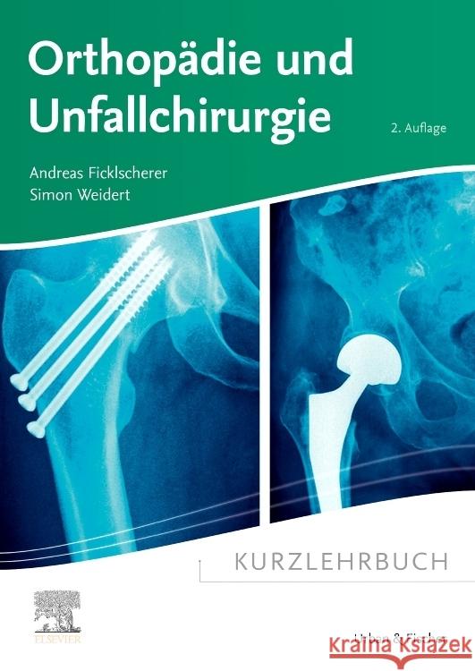 Kurzlehrbuch Orthopädie und Unfallchirurgie Ficklscherer, Andreas, Weidert, Simon 9783437411892 Elsevier, München