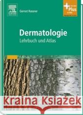 Dermatologie : Lehrbuch und Atlas. Mit dem Plus im Web. Zugangscode im Buch Rassner, Gernot Steinert, Ursula  9783437427633