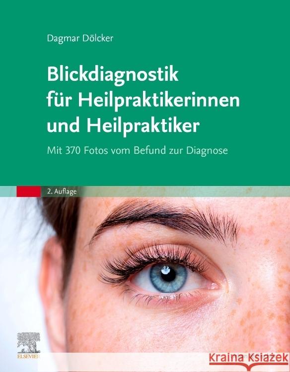 Blickdiagnostik für Heilpraktikerinnen und Heilpraktiker Dölcker, Dagmar 9783437587368 Elsevier, München