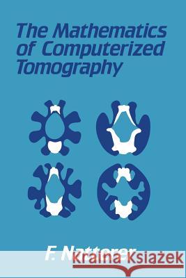 The Mathematics of Computerized Tomography F. Natterer 9783519021032 Vieweg+teubner Verlag