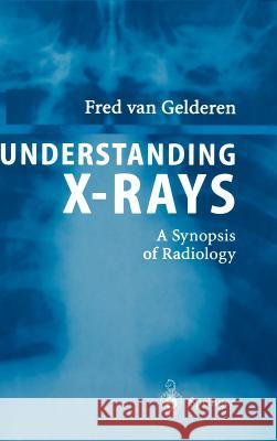 Understanding X-Rays: A Synopsis of Radiology Van Gelderen, Fred 9783540001379