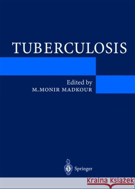 Tuberculosis Warrell, D. a. 9783540014416