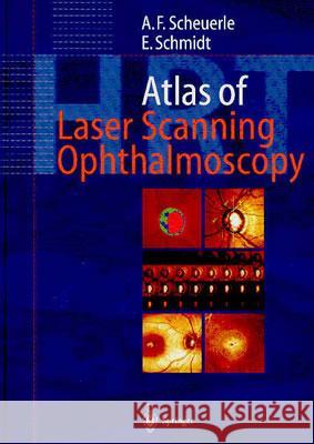 Atlas of Laser Scanning Ophthalmoscopy Scheuerle, Alexander Friedrich 9783540018681