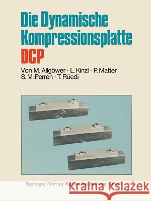 Die Dynamische Kompressionsplatte Dcp Allgöwer, Martin 9783540064657 Springer