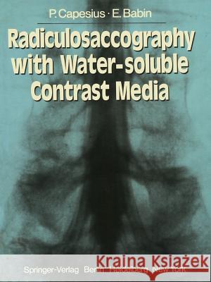 Radiculosaccography with Water-Soluble Contrast Media Wackenheim, A. 9783540085591 Springer