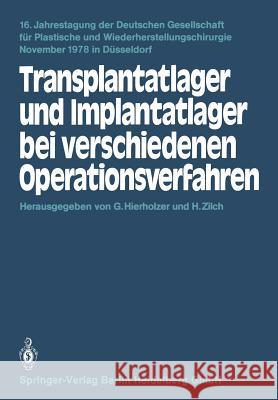Transplantatlager Und Implantatlager Bei Verschiedenen Operationsverfahren G. Hierholzer H. Zilch 9783540098331 Springer