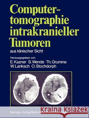 Computertomographie intrakranieller Tumoren aus klinischer Sicht E. Kazner, S. Wende, T. Grumme, W. Lanksch, O. Stochdorph, G.B. Bradac, U. Büll, R. Fahlbusch, R. Grumme, E. Kazner 9783540105404