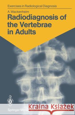 Radiodiagnosis of the Vertebrae in Adults: 125 Exercises for Students and Practitioners Wackenheim, Auguste 9783540116813