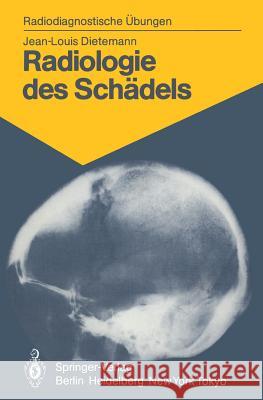 Radiologie des Schädels: 103 diagnostische Übungen für Studenten und praktische Radiologen J.-L. Dietemann, Eleonore Bromhorst 9783540137597