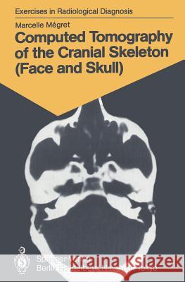 Computed Tomography of the Cranial Skeleton (Face and Skull): 58 Radiological Exercises for Students and Practitioners Megret, Marcelle 9783540153894 Springer