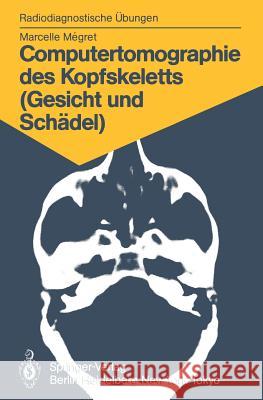 Computertomographie Des Kopfskeletts (Gesicht Und Schädel): 58 Diagnostische Übungen Für Studenten Und Praktische Radiologen Megret, Marcelle 9783540154600 Springer