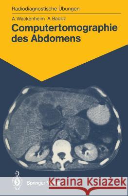 Computertomographie Des Abdomens: 85 Diagnostische Übungen Für Studenten Und Praktische Radiologen Hauenstein, Elisabeth 9783540165422 Springer